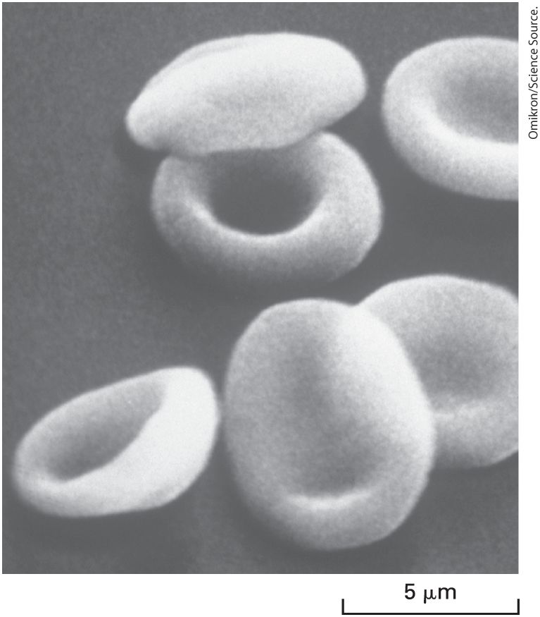Ch 10 fig (p. 1774)