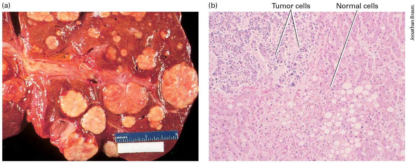 Ch 25 fig (p. 4303)