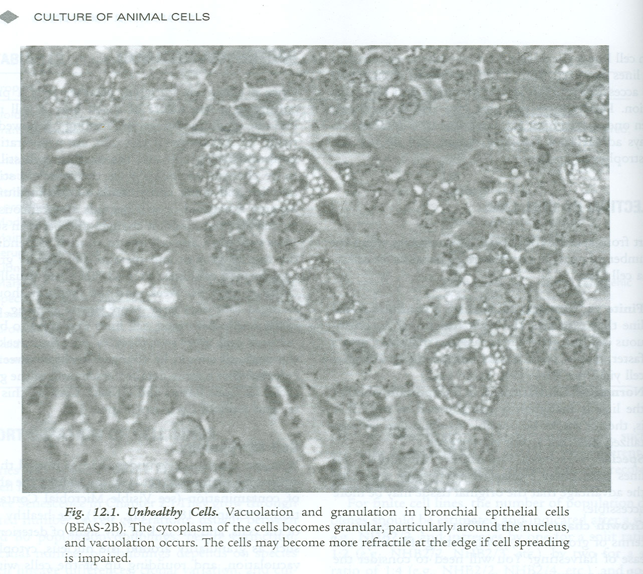 Judging culture health and density under phase contrast (lecture slide 9).