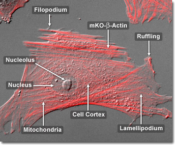 Identifying elements of motility - actin-driven leading edges (lecture slide 12).