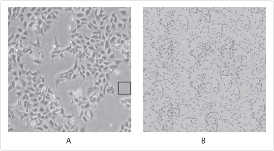 Bacterial contamination under phase contrast (Gibco cell culture basics) - human cells ~10 um vs bacteria ~1 um.