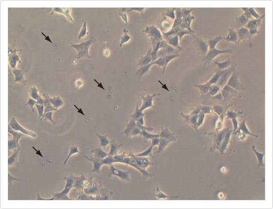 Yeast contamination - larger than bacteria, with characteristic budding.