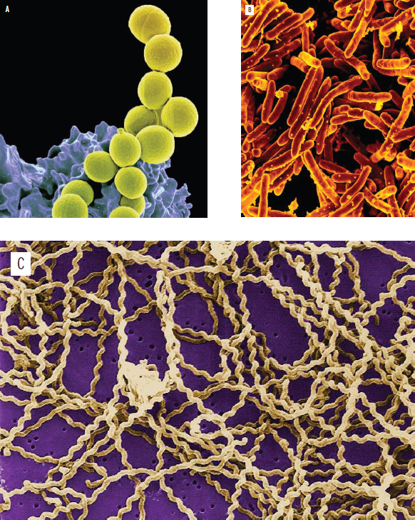 spherical bacteria, rod-shaped bacteria, spiral-shaped bacteria