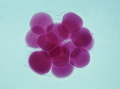 many cells that appear to be partially fused
