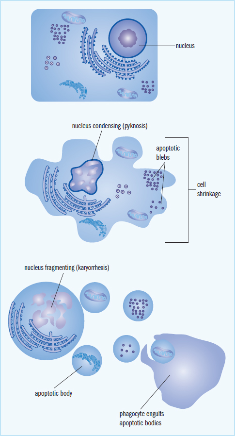 cell darkens, becomes smaller, and disintegrates into small vesicles (apoptotic blebs)