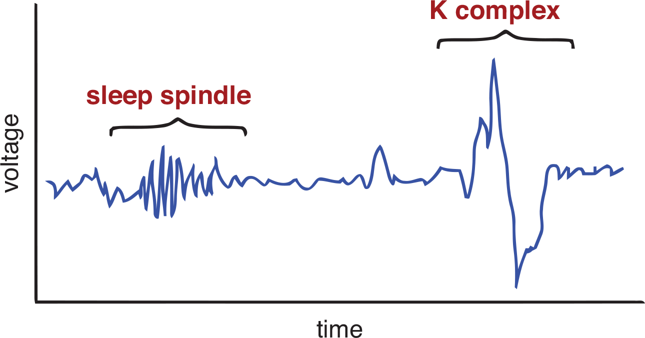 sleep spindle - tight, narrow grouping of small waves; K-complex - large upward and downward deviation from baseline