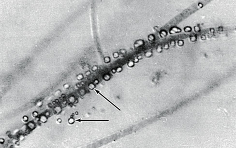 Ch 14 fig (p. 0)