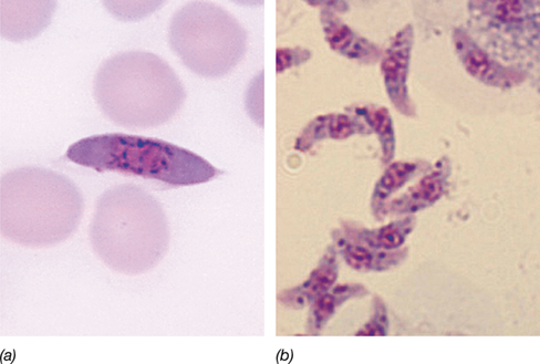 Ch 18 fig (p. 0)