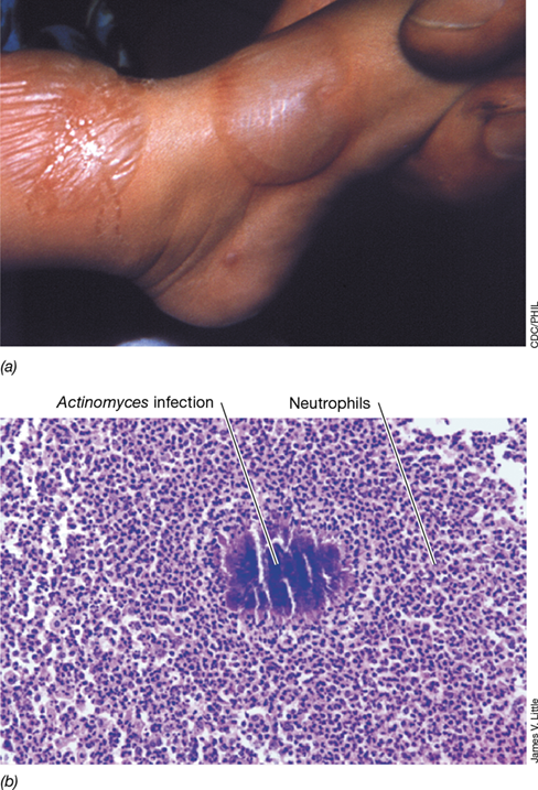 Ch 26 fig (p. 0)