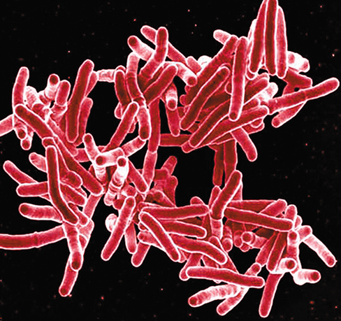 Ch 29 fig (p. 0)