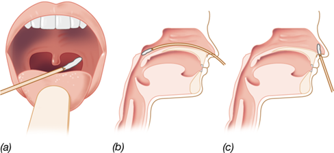 Ch 29 fig (p. 0)