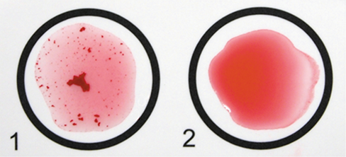 Ch 29 fig (p. 0)