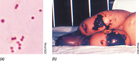 Ch 30 fig (p. 0)
