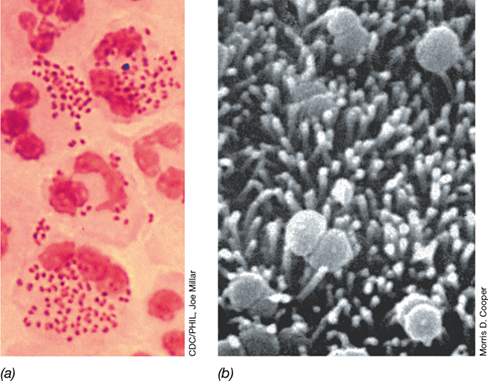 Ch 30 fig (p. 0)