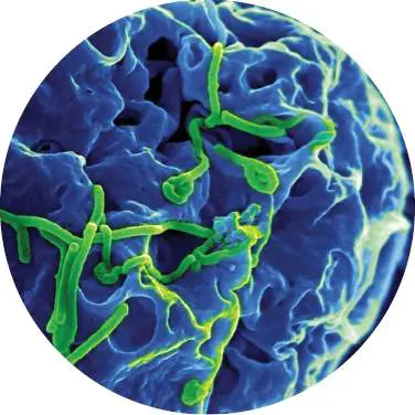 Figure from Chapter 1, Microbiology: An Evolving Science 6e