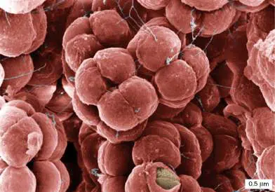 Figure from Chapter 1, Microbiology: An Evolving Science 6e