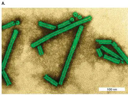Figure from Chapter 1, Microbiology: An Evolving Science 6e