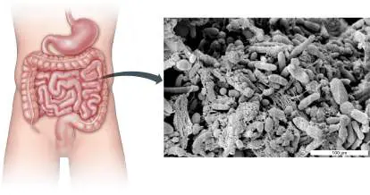Figure from Chapter 1, Microbiology: An Evolving Science 6e