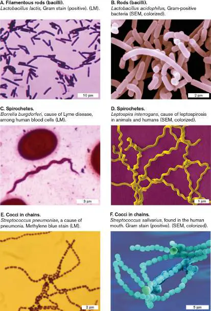 Figure from Chapter 2, Microbiology: An Evolving Science 6e