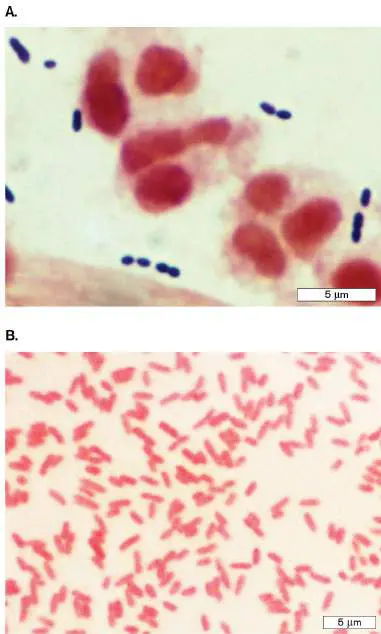 Figure from Chapter 2, Microbiology: An Evolving Science 6e