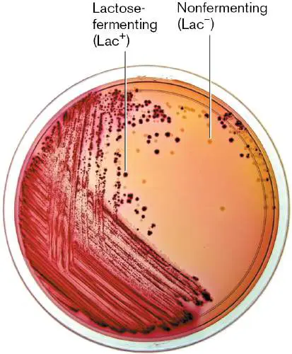 Figure 4.15 from Microbiology: An Evolving Science 6e