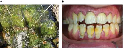 Figure from Chapter 4, Microbiology: An Evolving Science 6e