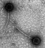 Figure from Chapter 6, Microbiology: An Evolving Science 6e