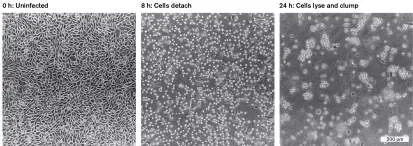 Figure from Chapter 6, Microbiology: An Evolving Science 6e