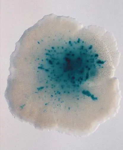 Figure from Chapter 9, Microbiology: An Evolving Science 6e