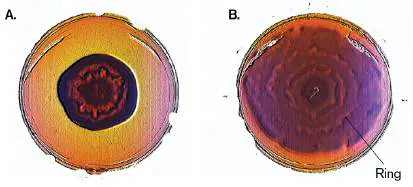 Figure from Chapter 10, Microbiology: An Evolving Science 6e