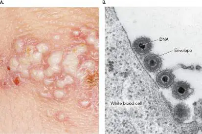 Figure from Chapter 11, Microbiology: An Evolving Science 6e