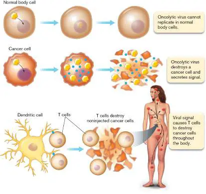Figure from Chapter 11, Microbiology: An Evolving Science 6e