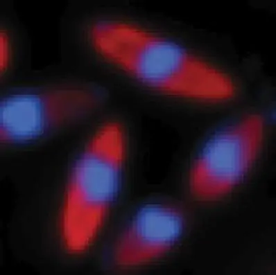 Figure from Chapter 12, Microbiology: An Evolving Science 6e