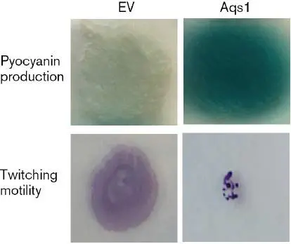 Figure from Chapter 12, Microbiology: An Evolving Science 6e