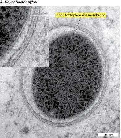 Figure from Chapter 14, Microbiology: An Evolving Science 6e