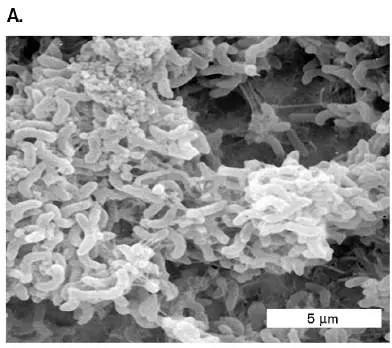 Figure from Chapter 14, Microbiology: An Evolving Science 6e