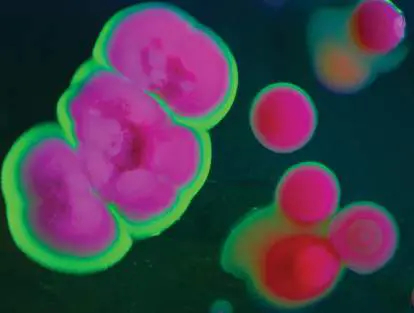 Figure from Chapter 15, Microbiology: An Evolving Science 6e