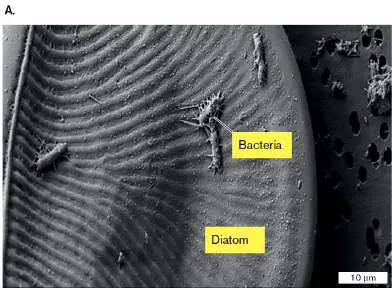 Figure from Chapter 15, Microbiology: An Evolving Science 6e