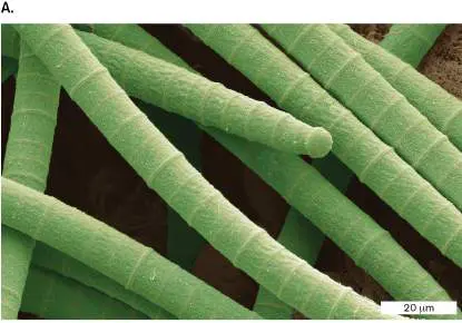 Figure from Chapter 15, Microbiology: An Evolving Science 6e