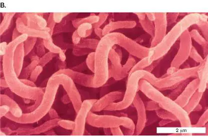 Figure from Chapter 15, Microbiology: An Evolving Science 6e