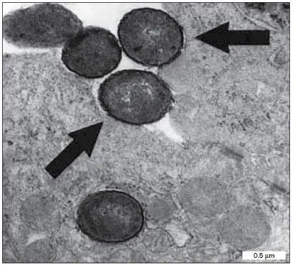Figure from Chapter 16, Microbiology: An Evolving Science 6e
