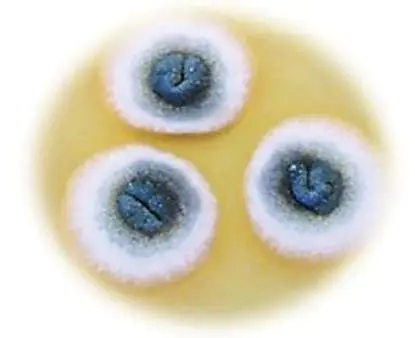 Figure from Chapter 16, Microbiology: An Evolving Science 6e