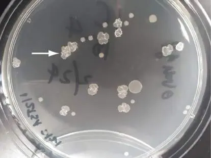 Figure from Chapter 17, Microbiology: An Evolving Science 6e