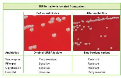 Figure from Chapter 17, Microbiology: An Evolving Science 6e