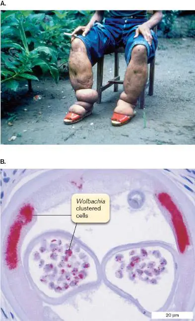 Figure from Chapter 17, Microbiology: An Evolving Science 6e