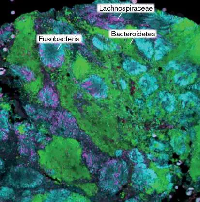 Figure from Chapter 18, Microbiology: An Evolving Science 6e