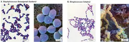 Figure from Chapter 18, Microbiology: An Evolving Science 6e