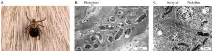 Figure from Chapter 18, Microbiology: An Evolving Science 6e