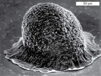 Figure from Chapter 18, Microbiology: An Evolving Science 6e