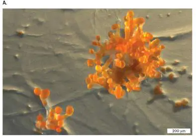 Figure from Chapter 18, Microbiology: An Evolving Science 6e